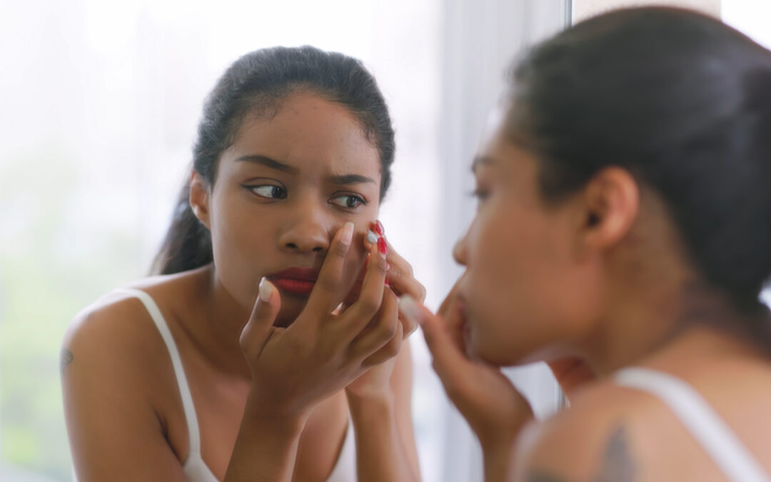 A close-up shot of a young woman looking at her reflection in the mirror. She is upset because she has a pimple.